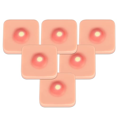 Image of Ultrassist Abscess I&D Incision and Drainage Pad (6-Pack), Sebaceous Cyst Removal Trainer, Suture Practice Skin Pad for Medical Education