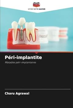 Paperback Péri-implantite [French] Book