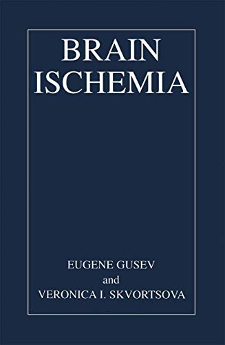 Brain Ischemia view 2