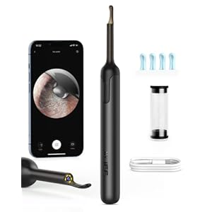 Ear Wax Removal, Bebird Ear Wax Removal Tool with 1080P Ear Camera,Earwax Removal Kit with 6LED Light,Ear Cleaner Built…