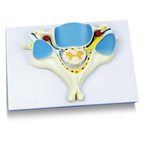 Image of EVOTECH SCIENTIFIC Enlarged Human Fifth Section Cervical Vertebra Anatomical Model with Spinal Cord, 7X Enlarged Transection Cervical Vertebra Model for Medical Learning Research Education Display