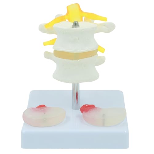 Image of 2 Section Lumbar Intervertebral Disc Human Skeleton Spine Model,Anatomical Vertebrae Model for Chiropractic,Patient Education Demonstration,Excellent Way for Demonstrating Disc