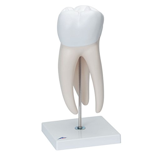 Image of 3B Scientific D15 Giant Molar w / Dental Caries 15x life-size 6-part - 3B Smart Anatomy
