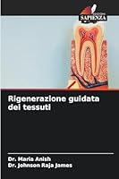 Rigenerazione guidata dei tessuti (Italian Edition) 6202457015 Book Cover