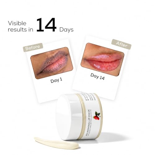 Image of Overnight Lip Repair Mask for Dark, Dry & Chapped Lips | Raspberry, Shea Butter & Jojoba Oil Lip Sleeping Mask for Deep Nourishment & Hydration | 10g