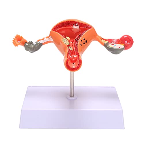 Nrpfell de úTero de Ovario AnatomíA de óRgano Reproductivo Femenino Muestra úTero Ovario Vagina EnseñAnza Uterina Cover