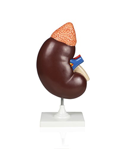 Image of VAU458 3X Kidney Model