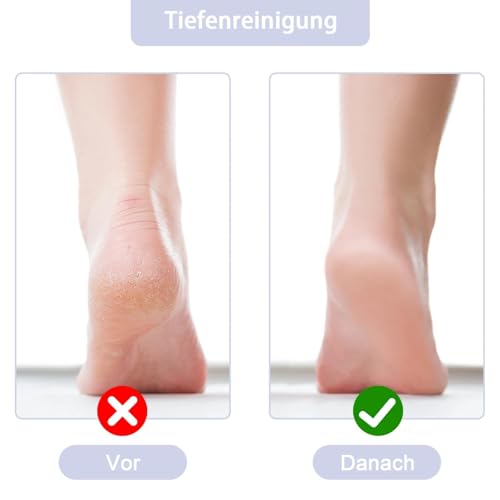 2 Stück Fußbürste, Silikon Matte Badematte, Fußbürste Dusche Fußmassagegerät, Fußwäscher Bath Massage Pad für Fußpflege Entspannung, Reinigt Peeling Massage(Gray, Blau)