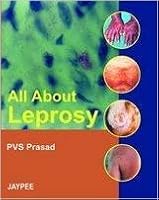 All About Leprosy 8180615286 Book Cover