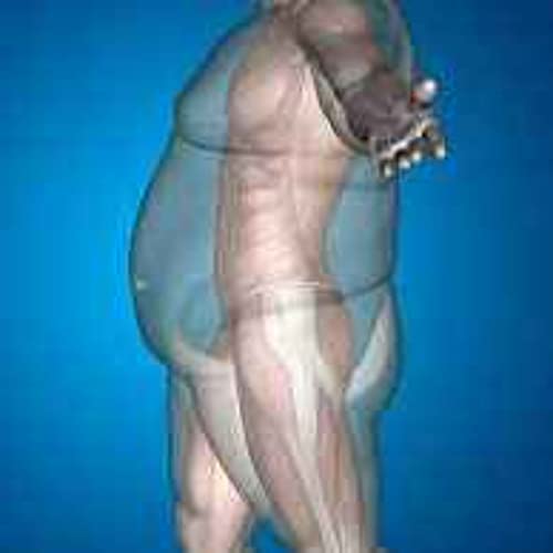 Gluttony: A Self Control Issue cover art
