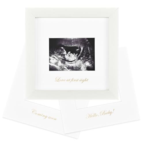 KINLINK Baby Sonogram Picture Frame, Love at First Sight Ultrasound Picture Frame, Pregnancy Gifts for Expecting Mom&Dad, Gender Reveal Party, Baby Keepsake Announcement White