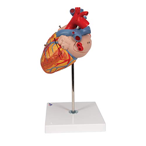 3B Scientific G12 Heart 2x life size 4 part - 3B Smart Anatomy - Thumbnail 5