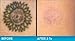 Tattoo Removal Cream 3 Step Action: The Daily Use of Profade Helps De-Color Tattoos in a Time Period of 3-9 Months