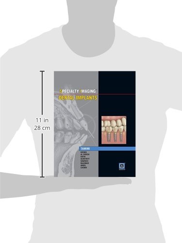 Specialty Imaging: Dental Implants #TOP1