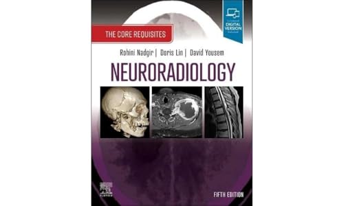 Neuroradiology:the core requisites