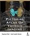 Produktbild PICTORIAL ATLAS OF THYROID IMAGING