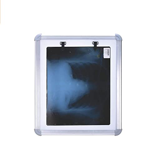 Image of Dr. Care X-ray View Box Flm With Automatic Film Activation and Variable Brightness Control(Size-14X17 Inch) /led display White