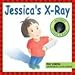 Jessica's X-Ray