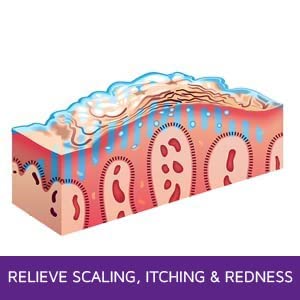 Miniatura 6 de Hidratante antipicazón (3 oz) Alivia rápidamente la picazón, la irritación y la sequedad de la piel o el cuero cabelludo. Alivia la picazón