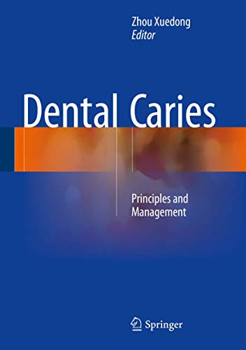 Dental Caries view 2