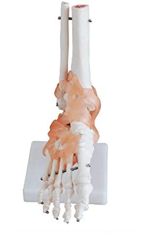 Xincheng Scientific Foot Joint Model with Ligaments