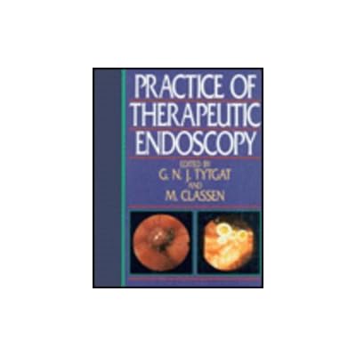 Practice of Therapeutic Endoscopy