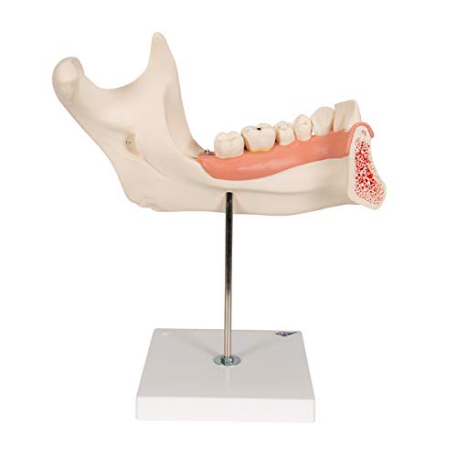 Image of 3B Scientific D25 6 Part Half Lower Jaw Model, 3 Times Full-Size, 13.8 inch x 7.1 inch x 14.2 inch