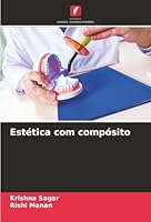 Estética com compósito (Portuguese Edition) 6208867274 Book Cover