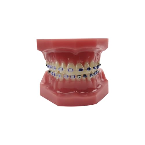 Orthodontisches Zahnmodell mit Halterungen, YOUYA DENTAL Demonstration Orthodontisches Modell für Bildung, Zähne Demonstration Typodonte Anatomisches Lehrwerkzeug mit Metall und Keramischer Halterung