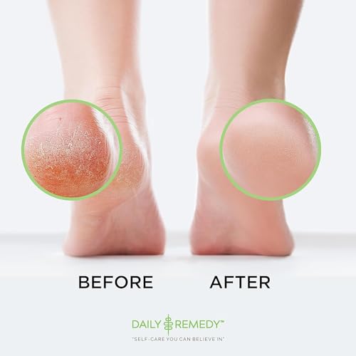 image for DAILY REMEDY EXTRA STRENGTH Tea Tree Oil Foot Soak with Epsom Salt - M