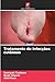 Tratamento de infec&Atilde;&sect;&Atilde;&micro;es cut&Atilde;&cent;neas (Portuguese Edition)