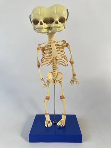 Fetal Fetus Skeleton Teaching Educational Model Double Head Baby Skull Skeleton