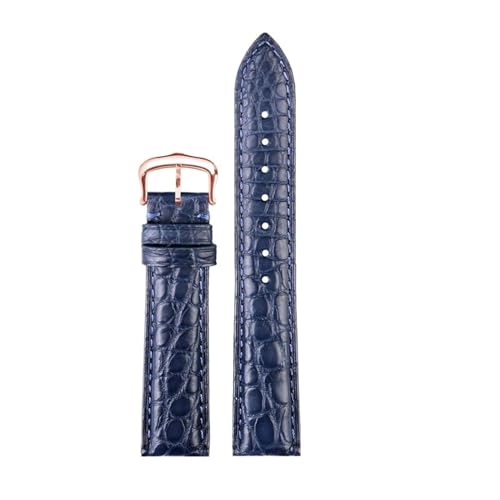 [-ł] JeBG YfB[X U[EHb`Xgbv L[}Xg h \ NR_CEHb`oh 16 18 19mm uXbgΉ(Blue-rose gold,17mm)