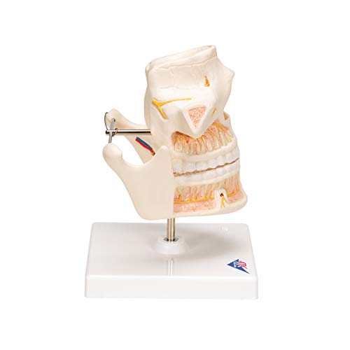 Image of 3B Scientific VE281 Adult Denture - 3B Smart Anatomy