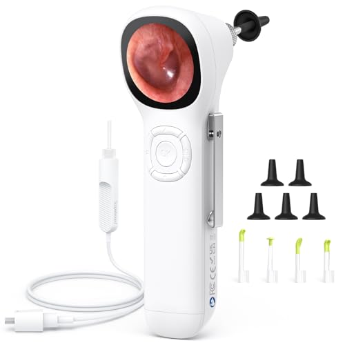 ScopeAround Digital Otoscope w/IPS Screen, 720p HD Smart Video Otoscope with Light, Ear Scope Otoscope with Camera Ear Wax Removal Camera, Ear Checker, Power On and Go, White