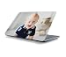 Produktbild RADANYA Crawl Baby Laptop Skin Aufkleber Passt Für Alle Modelle Für Bildschirmgrößen - 15 X 10 Zoll