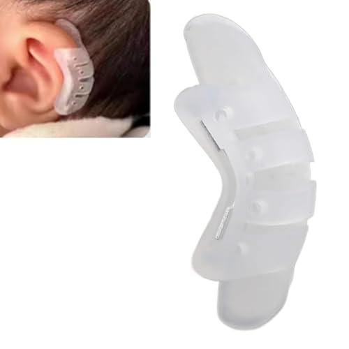 ZQESAMZ Correctores de Oreja para Recién Nacidos, Parche Corrector de Valgo de Aurícula para Orejas Protuberantes, Correctores Estéticos, Parches Adhesivos para Orejas Protuberantes