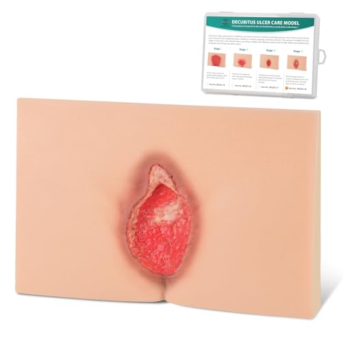 Image of Decubitus Ulcer Care Model, Bedsores Model