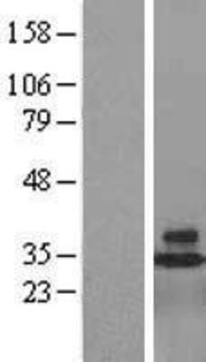 CD48/SLAMF2 Overexpression Lysate