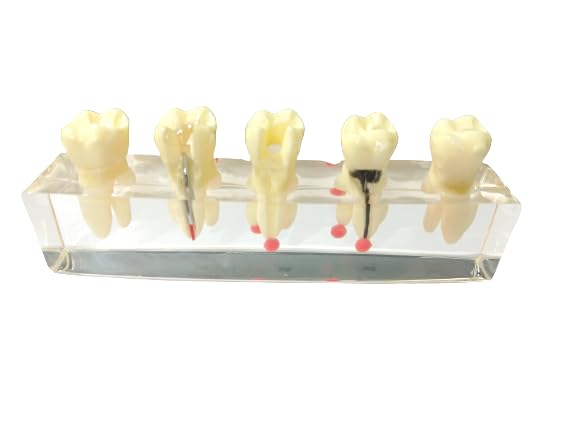 NMD Nexus Medodent Dental Endodontic Demonstration Root Treatment Model with Removable Crown (Pack Of 1 Pcs)-image-22