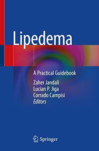 Lipedema: A Practical Guidebook (English Edition)