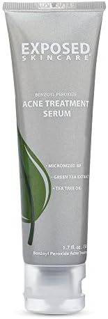 Exposed Skin Care Acne Treatment Serum Step 3 – Quickly Reduces Pimple Size and Redness - 12 Hour Spot Treatment - 3.5% Benzoyl Peroxide, Natural Green Tea & Tea Tree Oil