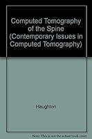 Computed tomography of the spine 0801621186 Book Cover