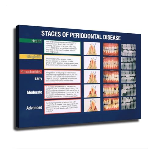 BIANMTSW Tableau mural dentaire professionnel – Diagramme d'anatomie des dents et guide d'hygiène bucco-dentaire pour l'éducation et la décoration des patients en clinique, encadré, 30 x 45 cm