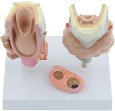 Thyroid Model Set Thyroid Pathology Model Human Thyroid Anatomy Model for School Teaching, Patient Education