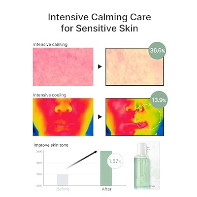 celimax The Real Cica Niacinamide AC Calming Serum 40ml | Hyaluronic Acid Redness Relief Moisturizing Soothing Restoring Serum Mild Formula for Sensitive Skin