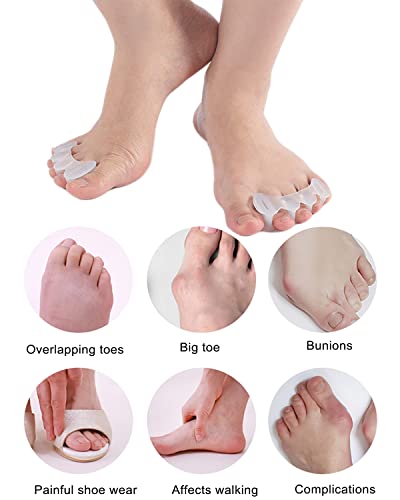 2pairs toe separators toe spacers for women men to correct bunion relieve feet pain foot alignment toe straighteners for hammertoes plantar fasciitis m women shoe size 9-125 men 7-11