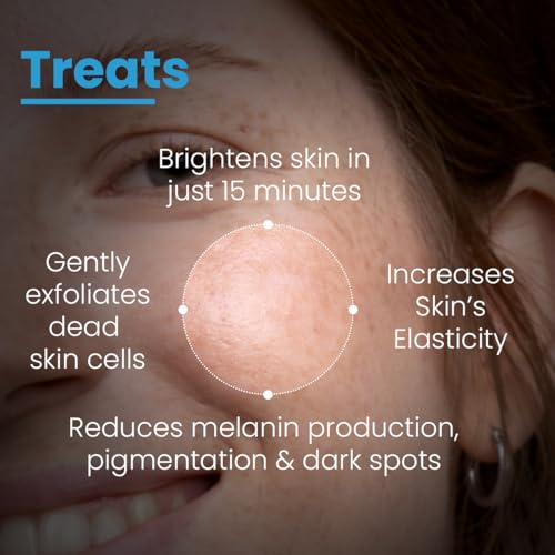 Image of FCL Brightening Face Mask | Kojic Acid Face Mask With Hyaluronic Acid For Glowing Skin | With PHA, BHA & AHA | Exfoliates Dead Skin & Shrinks Open Pores - 15g