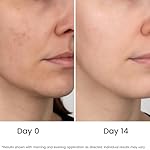 All Natural Pure 20% Vitamin C Serum For Face + 6 Active Boosters for Dark Spots, Wrinkles, Brightening, Hydrating, Even Tone, Healthy Glow with Niacinamide, Hyaluronic Acid, Ferulic Acid, Vitamin E - Image 4