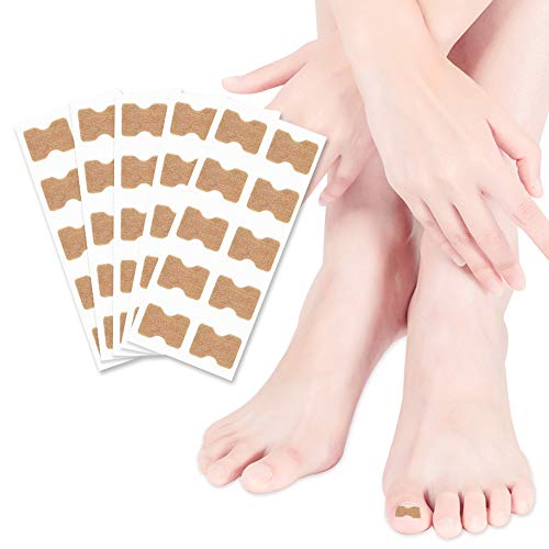 10 Sheet 100 pcs Ingrown Toenail Stickers Glue-free Toe Nail Correction Tools Professional Pedicure Tools, Foot Care Stickers for Unisex